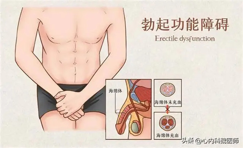 图片细节
